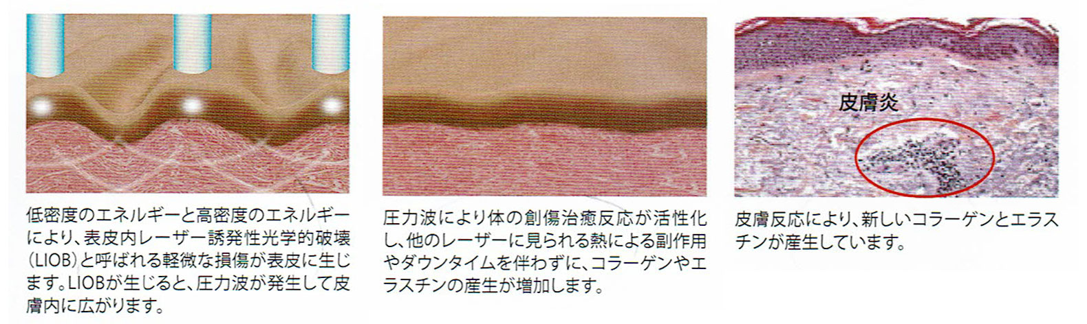 しみ| 上野医院