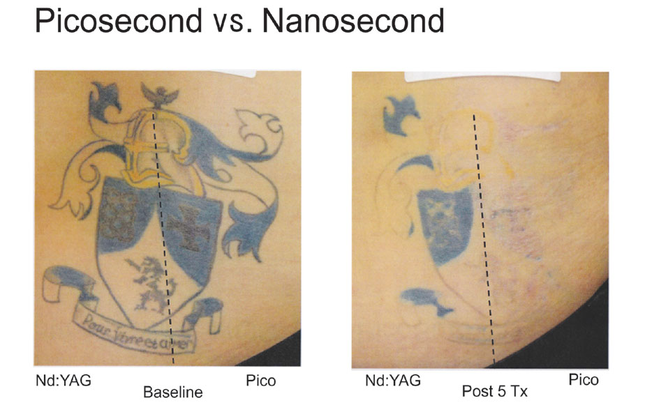 Pico vs Nano2